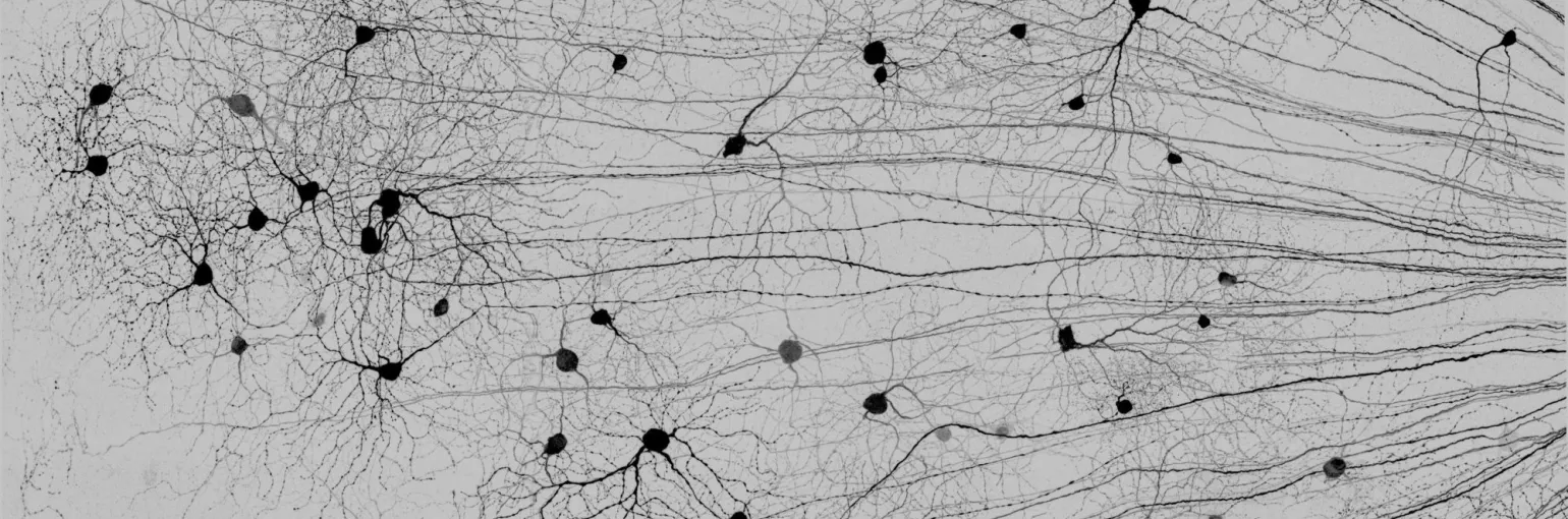 retina