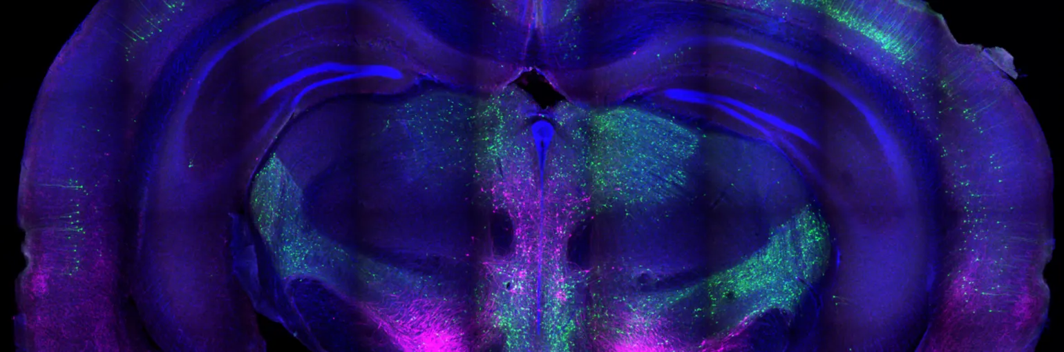 WholeBrainRabiesTHDapi